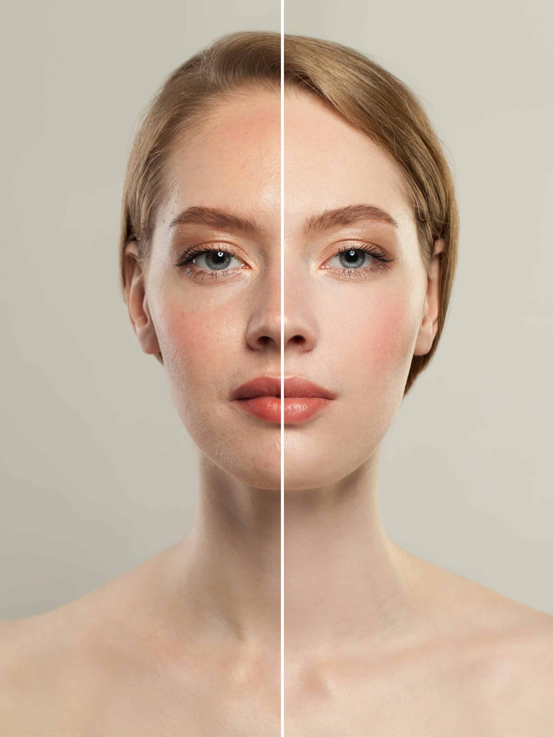 young-model-woman-face-with-retouching-without-retouching